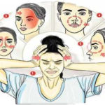 what is mucormycosis