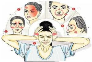 what is mucormycosis