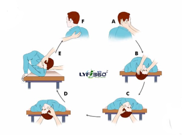 epley maneuver for BPPV